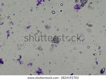 soil microorganisms under a microscope including amoeba, flagellates, nematodes, fungi, bacteria	