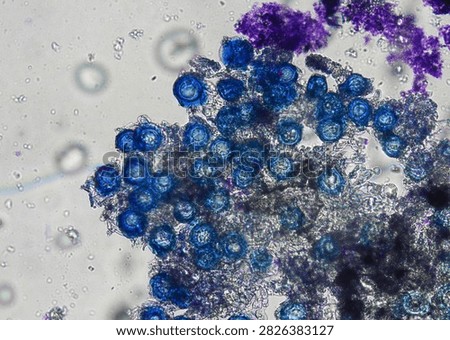 soil microorganisms under a microscope including amoeba, flagellates, nematodes, fungi, bacteria	