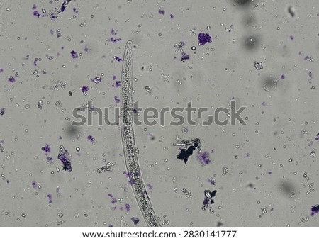 soil microorganisms under a microscope including amoeba, flagellates, nematodes, fungi, bacteria	