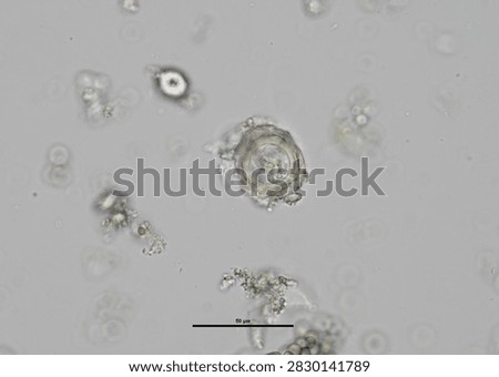 soil microorganisms under a microscope including amoeba, flagellates, nematodes, fungi, bacteria	