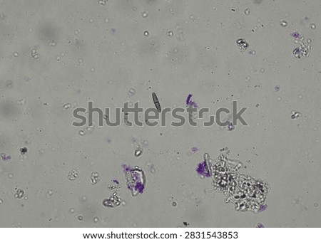 soil microorganisms under a microscope including amoeba, flagellates, nematodes, fungi, bacteria	