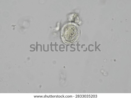 soil microorganisms under a microscope including amoeba, flagellates, nematodes, fungi, bacteria	