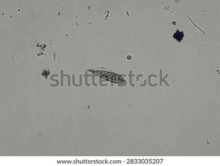 soil microorganisms under a microscope including amoeba, flagellates, nematodes, fungi, bacteria	