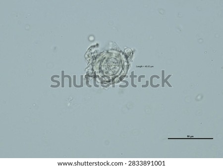 soil microorganisms under a microscope including amoeba, flagellates, nematodes, fungi, bacteria	