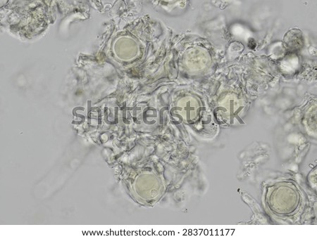 soil microorganisms under a microscope including amoeba, flagellates, nematodes, fungi, bacteria	
