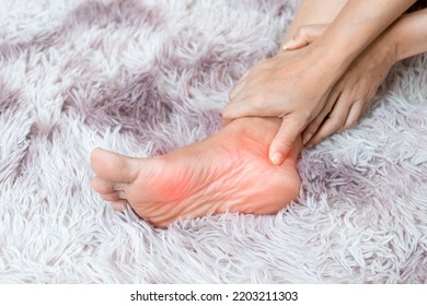 Soles Inflammation Of The Human Foot Bones