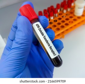 Soluble Transferrin Receptor Stfr Test This Stock Photo 2166599709 ...