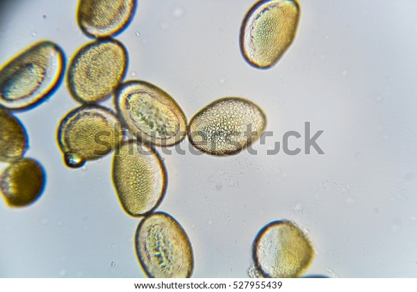 顕微鏡下のアマリリスの花粉がいくつか の写真素材 今すぐ編集