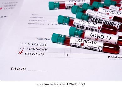 Some Test Tubes With Blood And Laboratory Report With A Positive Result For Coronavirus COVID-19