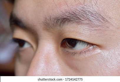 Southeast Asian, Chinese young man with single eyelid or monolid. A monolid means that there is no visible crease line below your brow area. Closeup view. Right eye is in blurred mode.