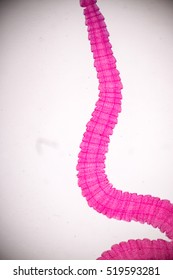 sparganum (parasite) under the microscope - Shutterstock ID 519593281