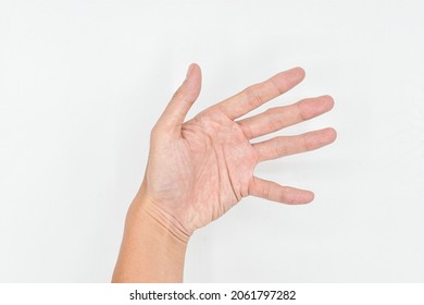 Spastic Hand. Hand Muscle Spasticity. Concept Of Hand Health.