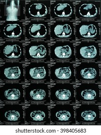 Special Photography, Abdominal CT Scan Images                         