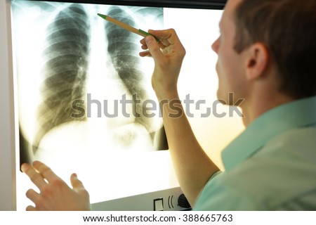 specialist watching image of chest   at x-ray film viewer
