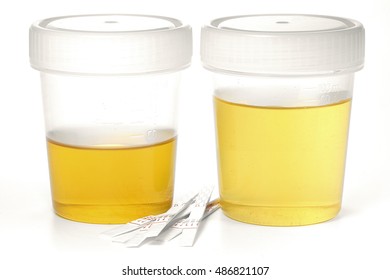 specimen cups for urinalysis with test stripes isolated on white background