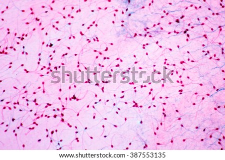 Sperms viewed from the microscope.