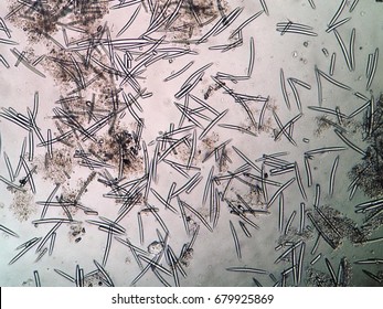 Spicules In Porifera Is The Structure That Supports Porifera's Body, Mainly Composed Of Silica.