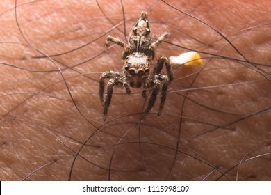 Spider Bite Leg