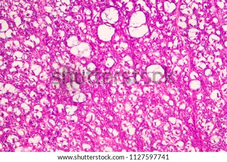 Spinal cord nerve cell section under microscope for education