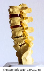 Spine Disc Degenerated By Osteophyte Formation 