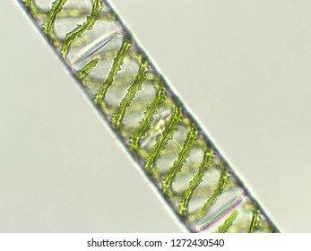 Spirogyra Sp. Algae Under Microscopic View X40 - Chlorophyta