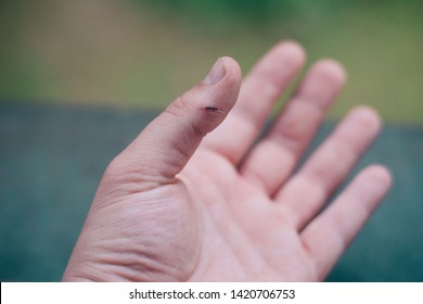 Splinter in the finger after the hard job in wood factory