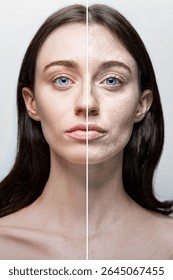 A split image of a woman's face showcasing a comparison of her natural skin condition and after treatment results, emphasizing skincare effects and awareness of natural beauty.