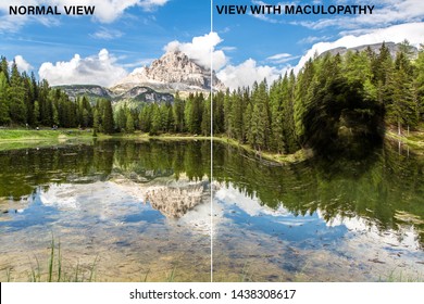 A split screen view of a scenic lake by a large mountain in the alps. Showing the before and after vison of a diabetic person with a dark spot of maculopathy in field of vision.
