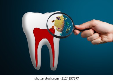 Spoiled Rotten Tooth Concept Illustration Isolated Stock Photo ...