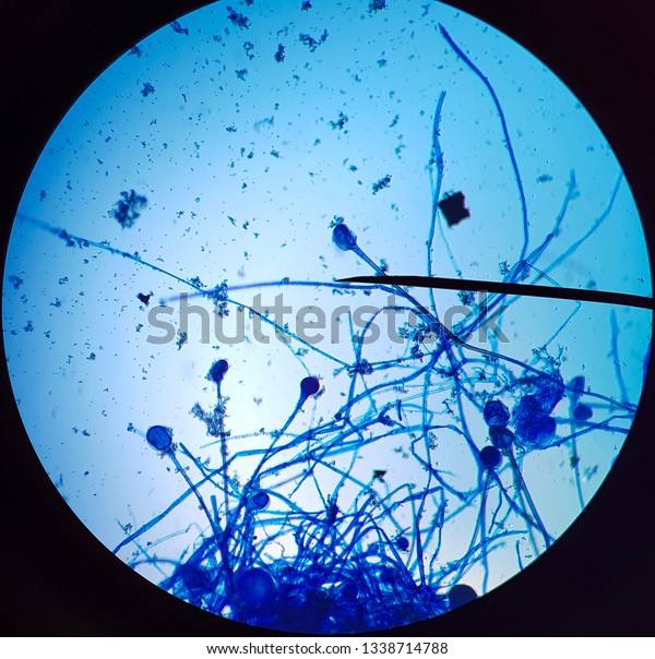 Sporangiospore Microscopes Stock Photo (Edit Now) 1338714788