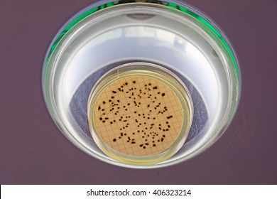 Spores Of Clostridium Perfringens On A Petri Dish (TSC Agar Used)