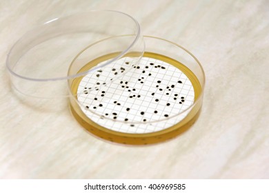 Spores Of Clostridium Perfringens On A Petri Dish (TSC Agar Used)