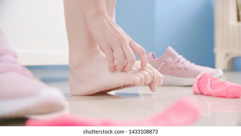 Sport Woman Has Athletes Foot And Itching Her Barefoot