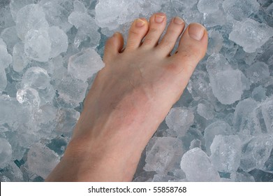 Sports Injury On Ice Cube Bath Concept