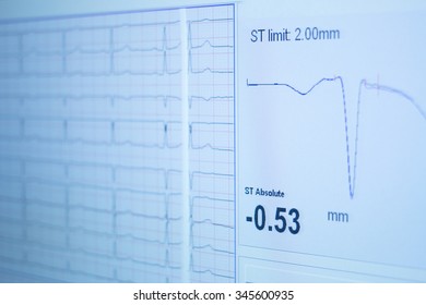 Sports Performance Professional Fitness, Power, Endurance And Strength Evaluation Test With Gas Analysis And Echocardiogram In Medical Center Of Sports Gymnasium. 