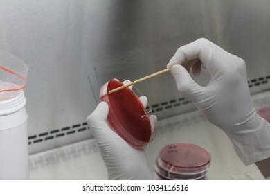 Sputum Culture Bacteria Culture Microbiology