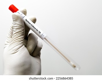Sputum Culture Test for the diagnosis of Tuberculosis (TB). - Shutterstock ID 2256864385