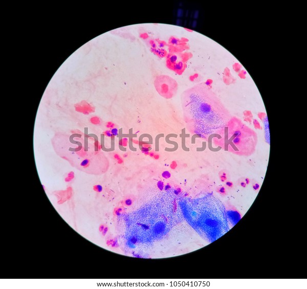 Sputum Gram Stain Shown Many Neutrophils Stock Photo (Edit Now) 1050410750