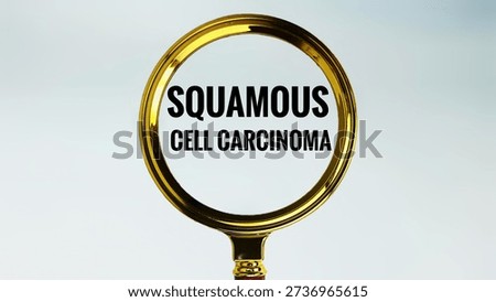 Squamous Cell Carcinoma Concept Through Magnifying Glass Highlighting Malignant Skin Tumor for Medical Diagnosis and Oncology Awareness. 