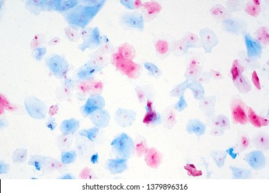 Squamous Epithelial Cells Under Microscope View Stock Photo (Edit Now ...