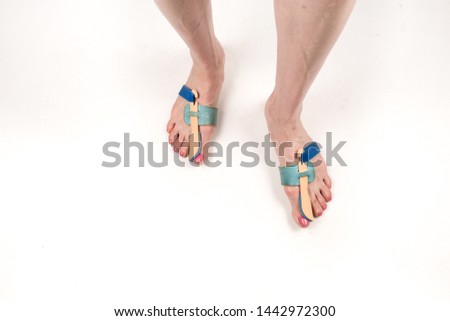 stabilizing orthosis for the correction of the big toe on the woman legs when hallux valgus, 2 legs, close-up isolated, white background