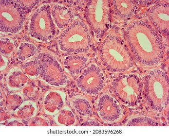 Stained Gastric Mucosa Membrane In Stomach Under Microscope.