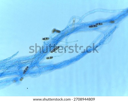 Stained Light Micrograph of Multispored Asci (Ascospores) within Hyphae, Indicating Sexual Reproduction in Ascomycota