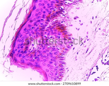 Stained Microscopic Section of Human Stratified Squamous Epithelium Showing Dermal Papilla and Cellular Layers