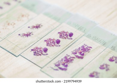 Stained Tissue Biopsy On Glass Slides In Pathology Laboratory