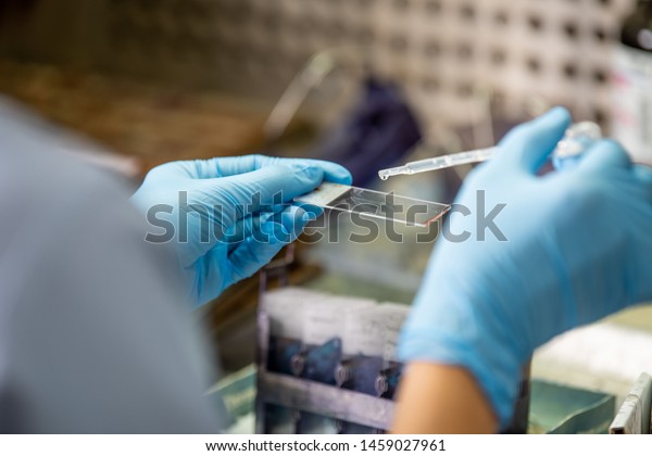 staining slide\
Pap smear for\
cytology,laboratory.