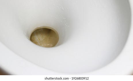 Stains Dirty Inside The White Toilet Bowl.