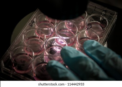 A standard 12-well cell culture dish containing human stem cells placed under an inverted biological microscope for routine inspection. Setting: biological research lab, equipment: gloves, microscope.