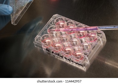A standard 12-well cell culture dish containing human stem cells held by a researcher doing normal lab work. Setting: sterile tissue culture hood, equipment: gloves, vacuum pump, pipette.