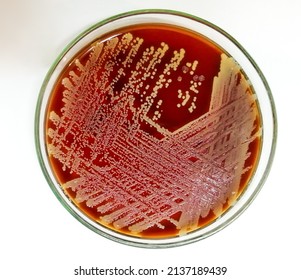 Staph aureus: Gram positive bacteria. Staphylococcus or streptococcus growth on blood agar.